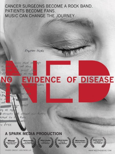 No Evidence of Disease