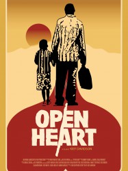 Open Heart