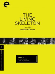 The living Skeleton